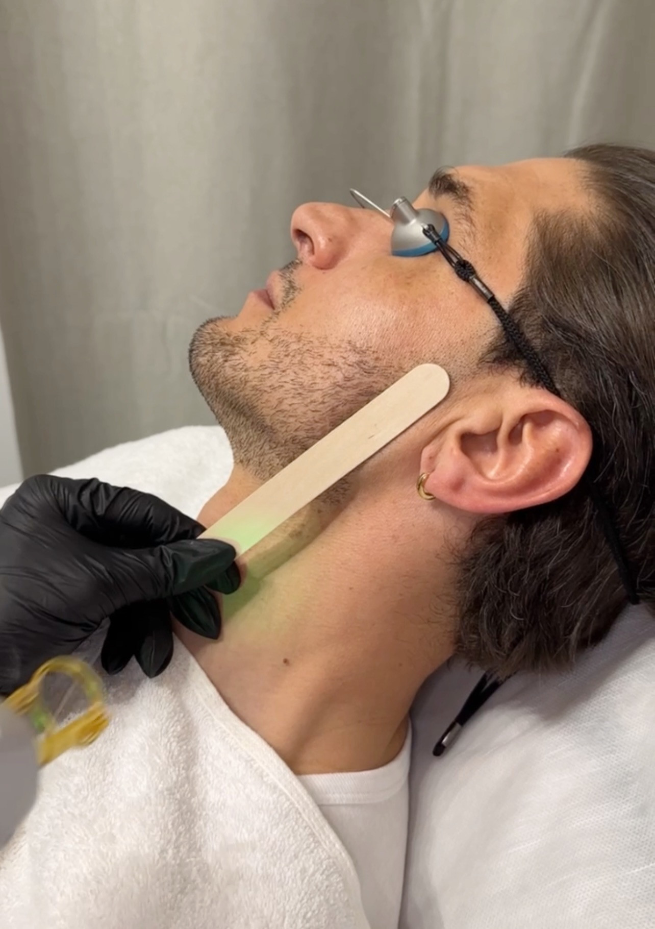 Haarentfernung Herren - Removity München