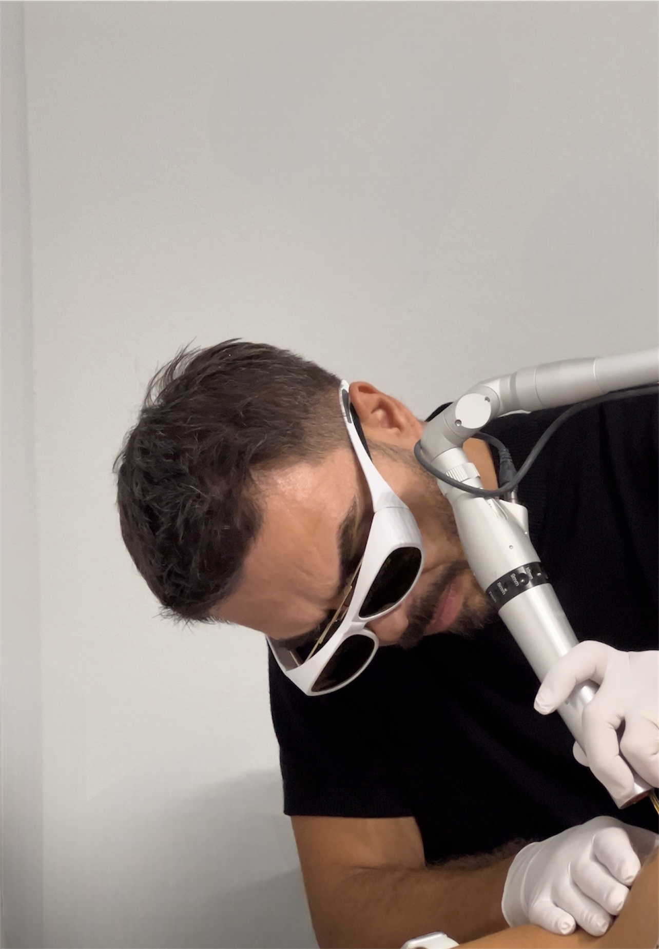 Tattooentfernung - Removity München